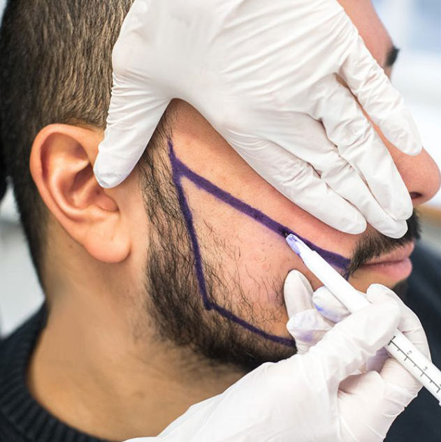 Beard treatment