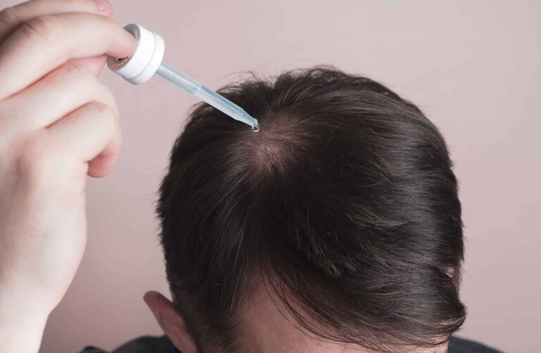 Hair Fall Treatment