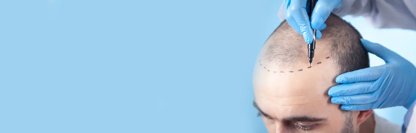 Transform Your Hair, Life - With India's best hair treatment Experts