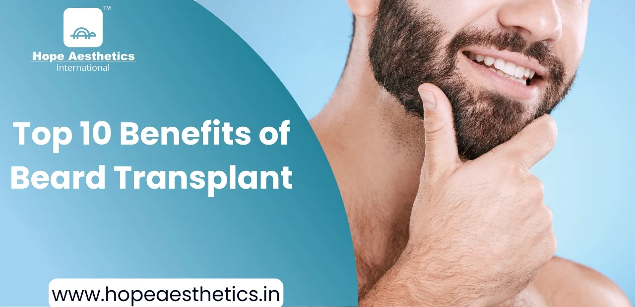 Top 10 Benefits of Getting a Beard Transplant