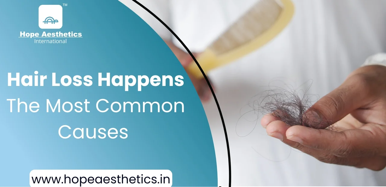 Why Hair Loss Happens: The Most Common Causes Explained