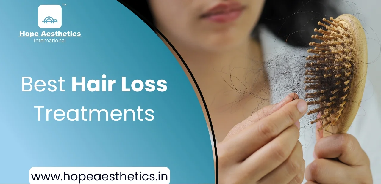 Best Hair Loss Treatments – Best Solutions for Hair Regrowth