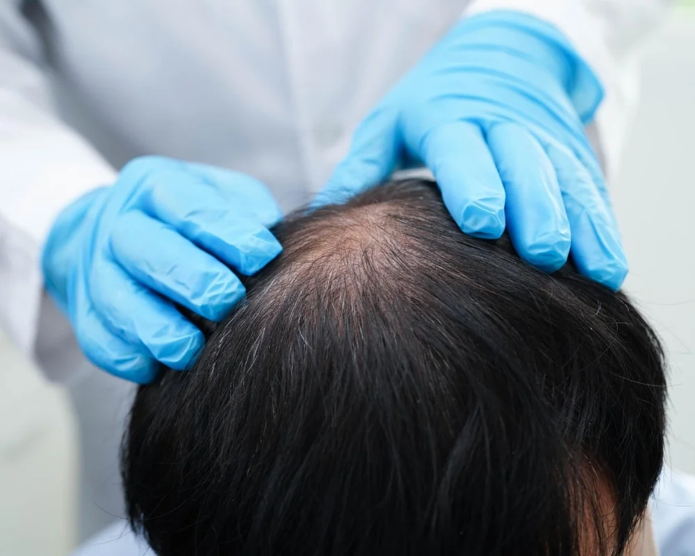 Advanced EXOS-GFC+ Treatment in Pune -Hope Aesthetics Clinic